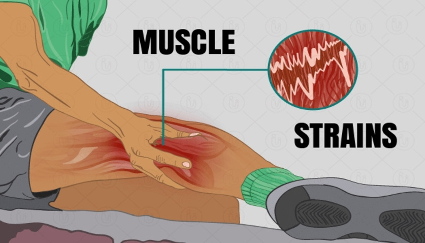 Dr. Naval Parikh: Sprain and Muscle Strain Treatment & Guide